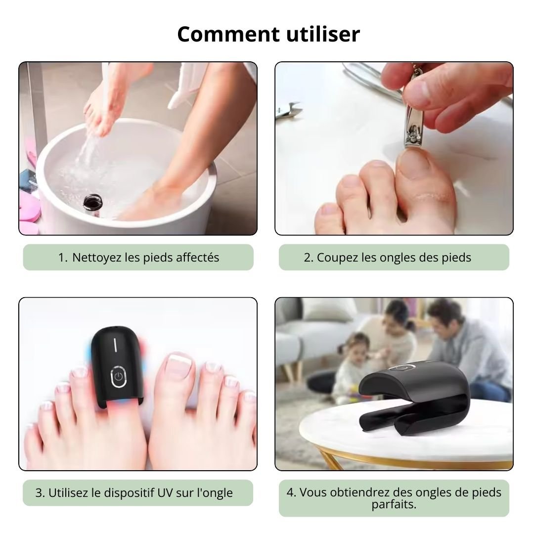 Appareil de traitement des Mycoses Rapide - Semello.fr