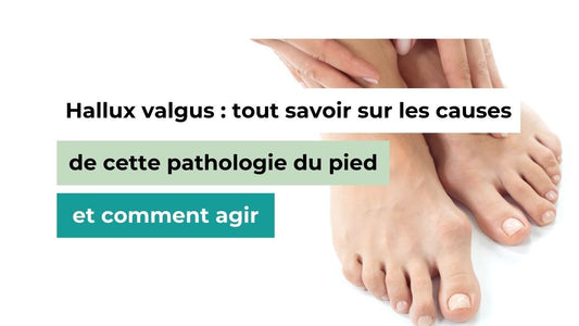 Hallux valgus : tout savoir sur les causes de cette pathologie du pied et comment agir - Semello.fr