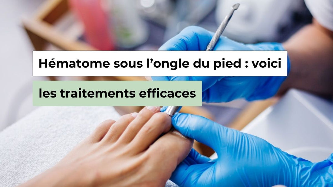 Hématome sous l’ongle du pied : symptômes, durée et solutions efficaces - Semello.fr