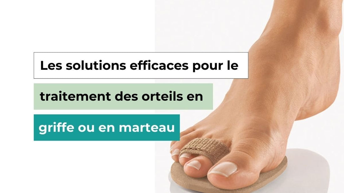 Les solutions efficaces pour le traitement des orteils en griffe ou en marteau - Semello.fr