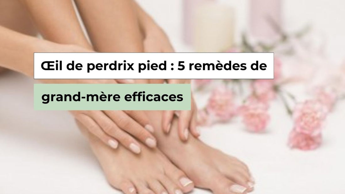 Œil de perdrix au pied : 5 remèdes de grand-mère efficaces selon les experts - Semello.fr