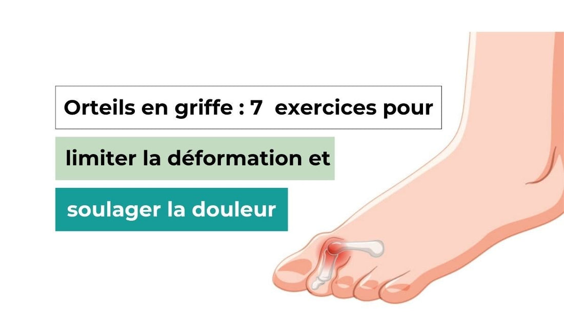 Orteils en griffe : 7  exercices pour limiter la déformation et soulager la douleur - Semello.fr