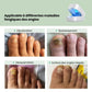 Appareil de Traitement UV des Mycoses - Semello.fr