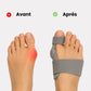 Attelle Hallux Valgus Articulable - Semello.fr