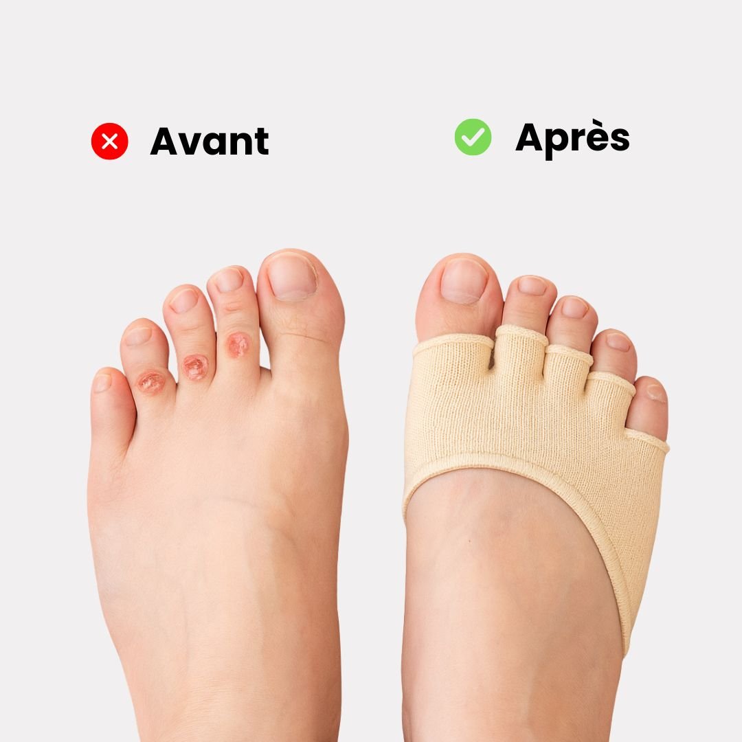 Chaussettes Séparatrices d'Orteils Relax - Semello.fr