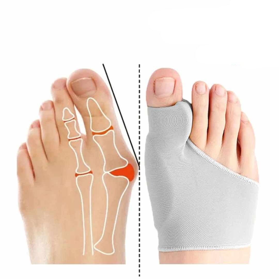 Coffret Hallux Valgus "Bien - Être" - Semello.fr