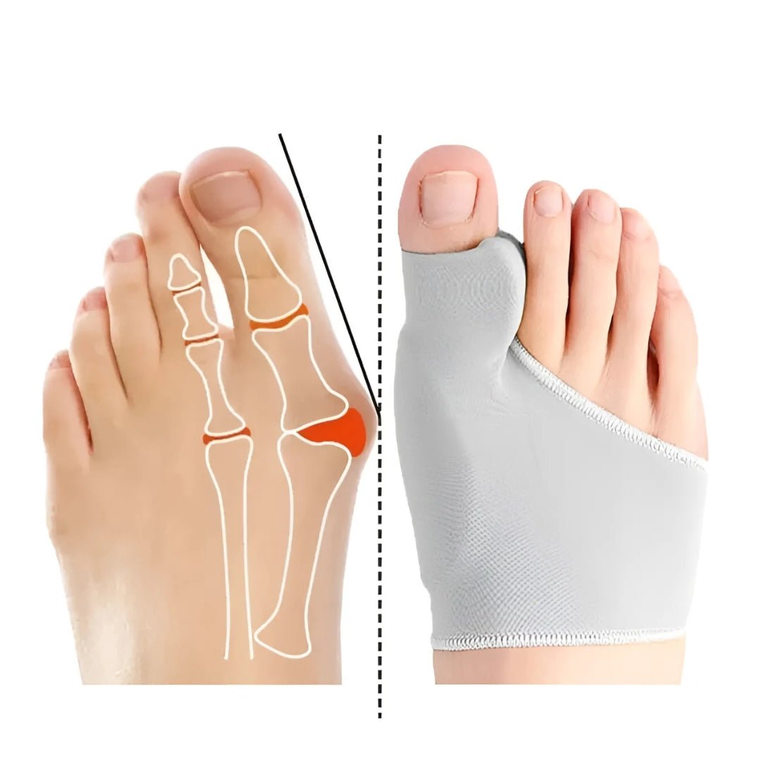 Coffret Hallux Valgus "Prévention & Marche Saine" - Semello.fr