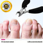 Coupe Ongles pour Ongle Incarné - Semello.fr