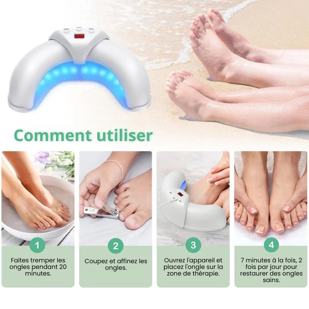 OrthoLaser® - Traitement des Mycoses aux Ongles - Semello.fr
