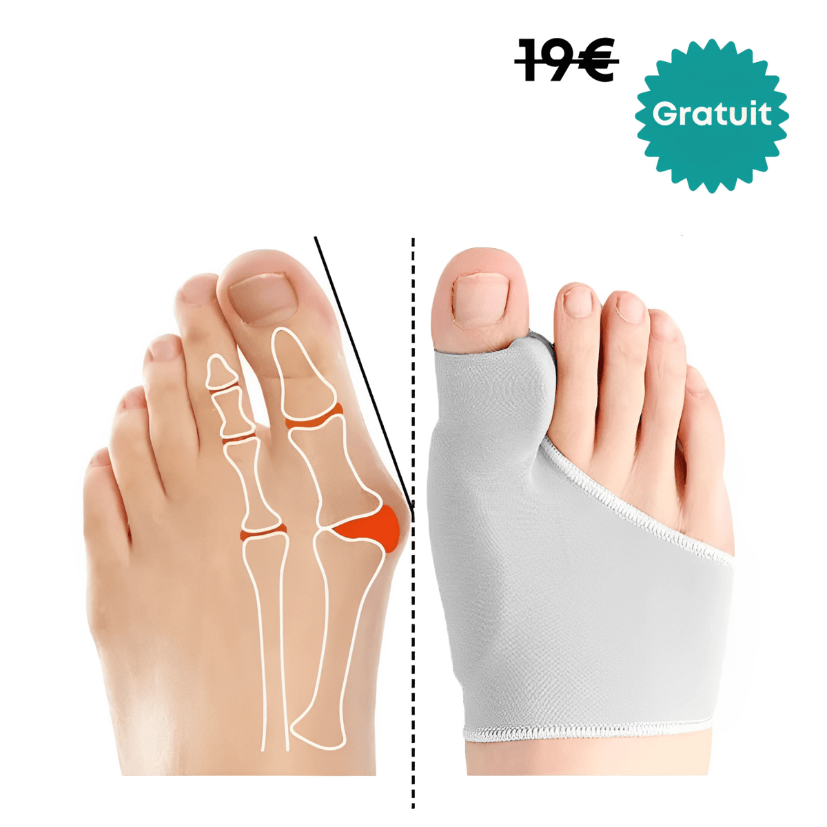 Pack De Traitement Complet - Semello.fr