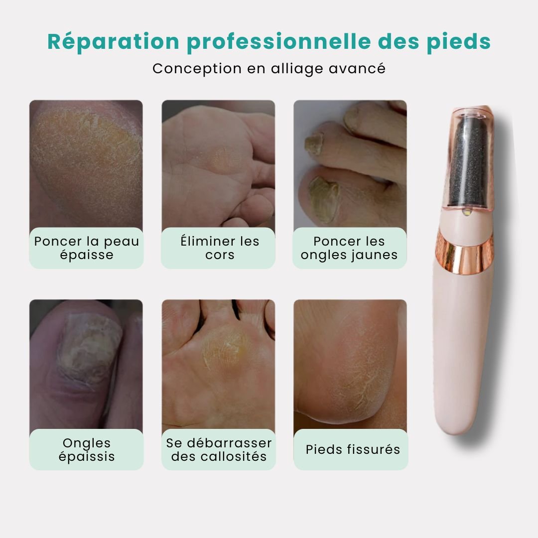 Râpe Électrique Anticalosités – Pieds Doux & Lisses - Semello.fr
