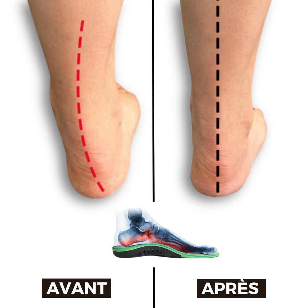 Semelles Orthopédique Douleur Plantaire - Semello.fr