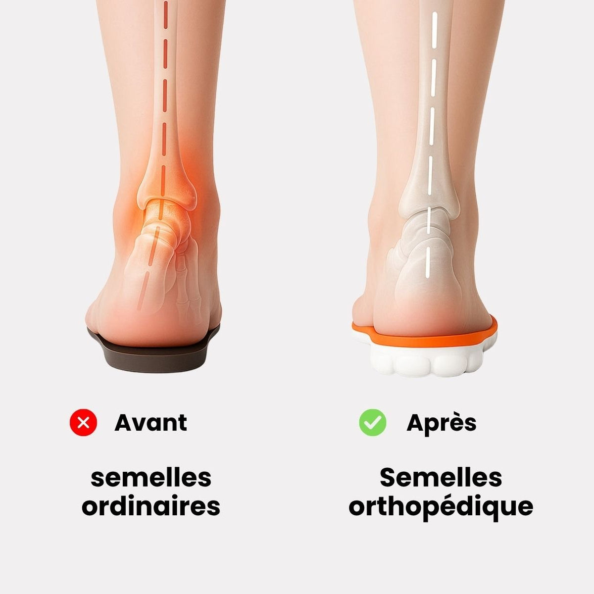 Semelles orthopédique en mousse - Semello.fr