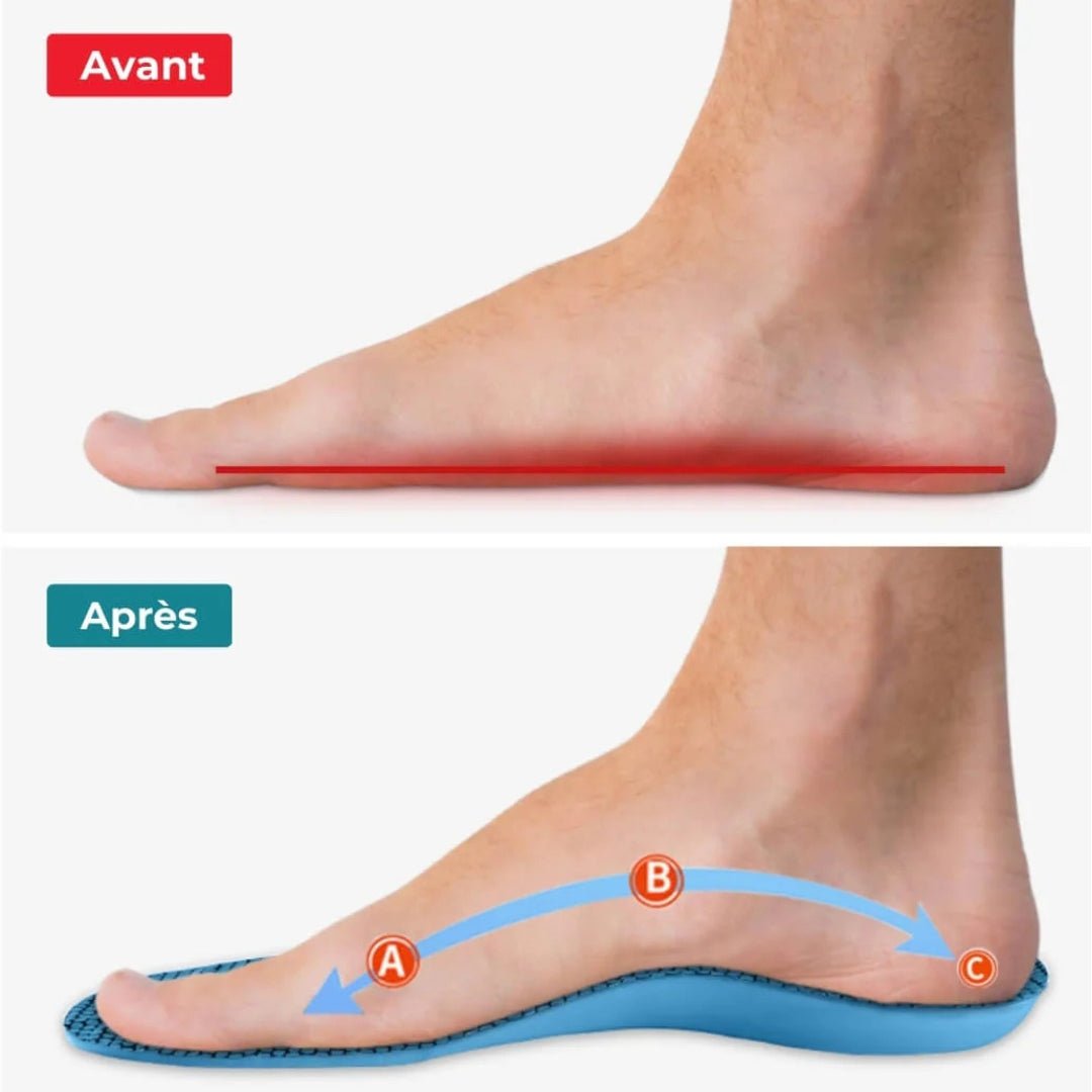 Semelles orthopédiques hallux valgus - Semello.fr