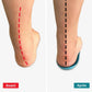 Semelles orthopédiques hallux valgus - Semello.fr