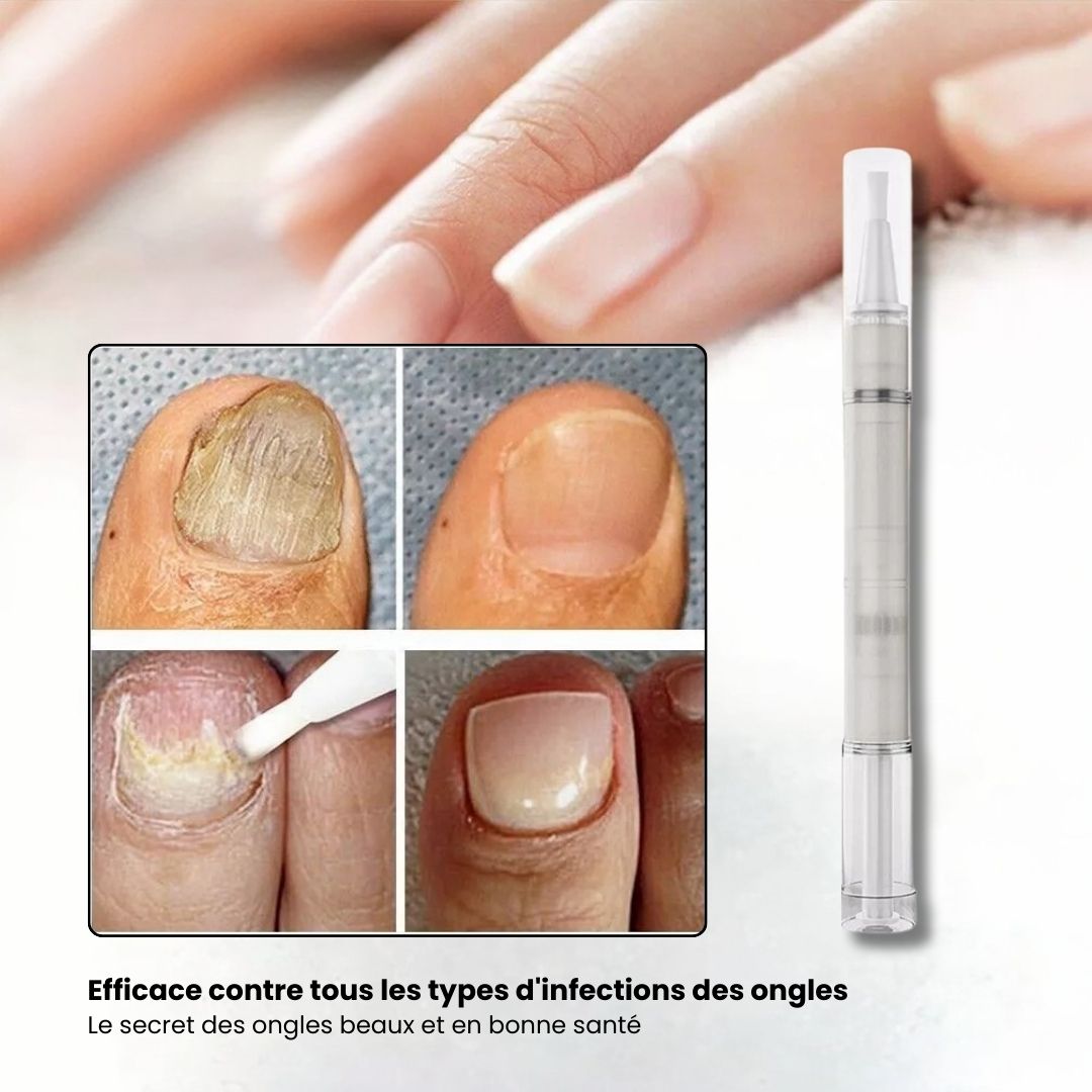 Stylo de Sérum anti - mycose - Semello.fr