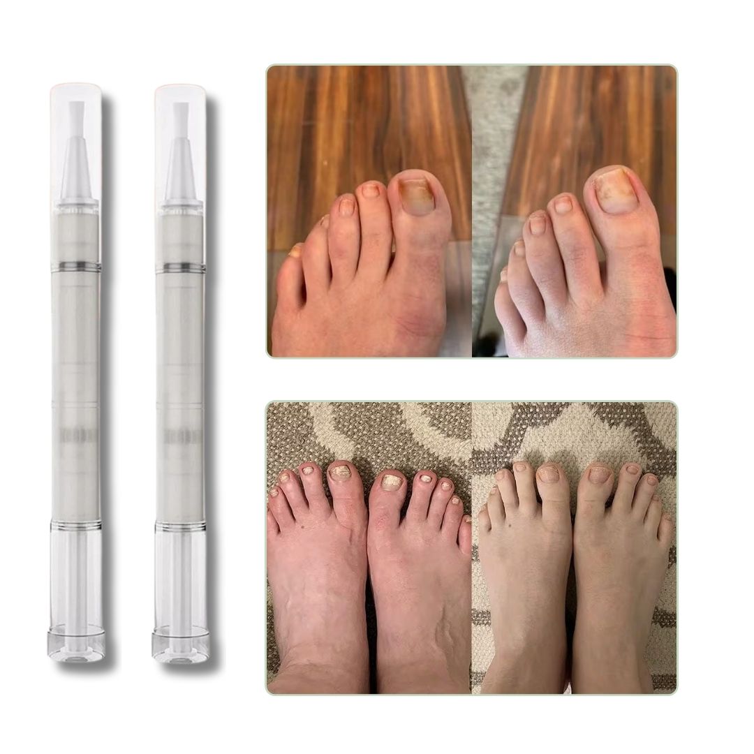 Stylo de Sérum anti - mycose - Semello.fr