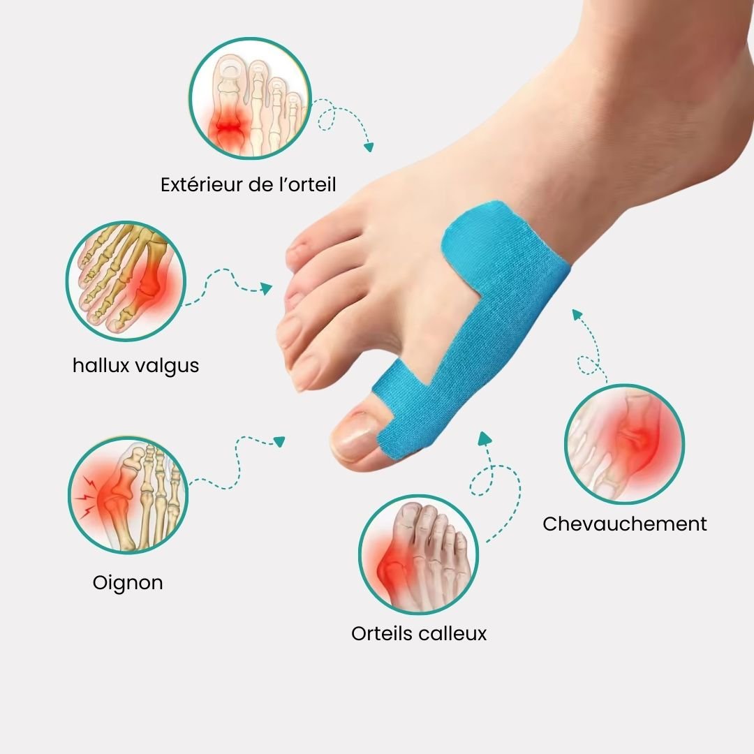 Tape pour Hallux Valgus | Soulagement & Correction - Semello.fr